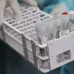 Research finds Omicron present before Delta and Beta variants