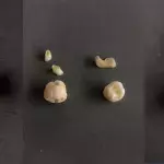 She Made Earrings Out Of Her Wisdom Teeth