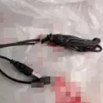 Teenage boy undergoes surgery after sticking knotted USB cable into his penis