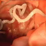 This Thai Man Filmed Himself Pulling A 10-Meter Tapeworm From His Backside