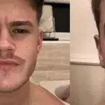 Warns Against Dying Your Mustache For Movember