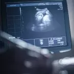 The woman had a baby growing inside her liver
