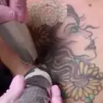 A Woman Tried To Remove Her Chest Tattoo And The Outcome Is Horrific