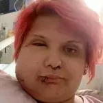 Woman’s face swells to twice the size after brushing against this toxic plant