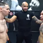 'Synthol Kid,' A Young Russian With Massive Arms