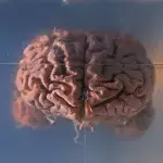 Default image