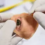 Doctors Craft A Prosthetic For A Woman's Missing Eye With A Phone And A 3D Printer