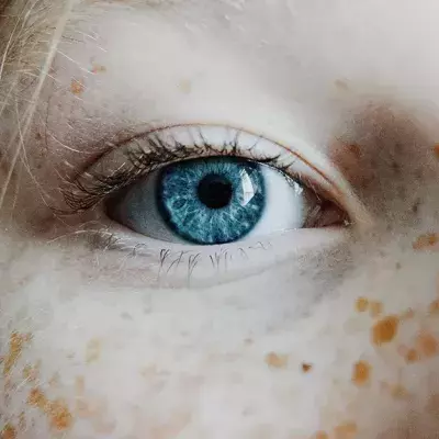 Blind