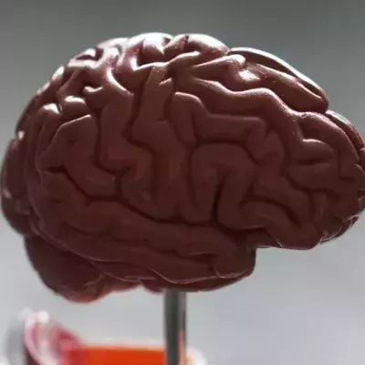 Brain 