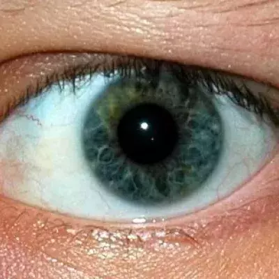 Default image