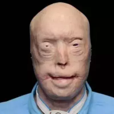 Default image