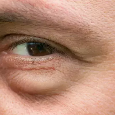 Default image
