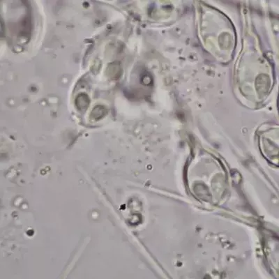 Henneguya salminicola