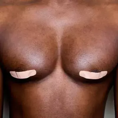 male nipples