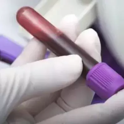 Only 40 people in the world have gold blood, and this allows them to save lives.