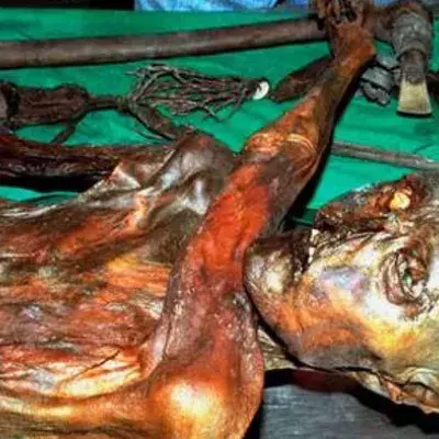 Ötzi