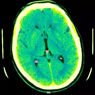 A strange brain disease is on the rise in Canada and has authorities worried