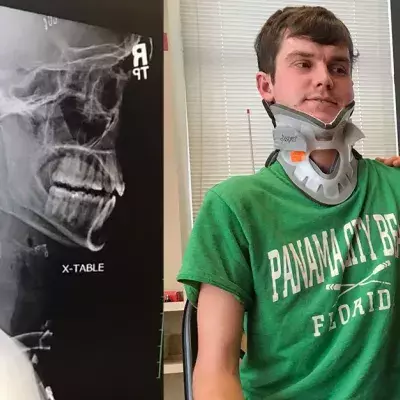 22-Year-Old Cheats Death For A Third Time By Surviving A Deadly 'Internal Decapitation'