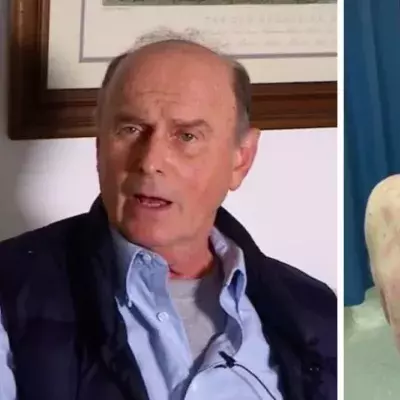 74-year-old patient sees skin 'peeling off' after being vaccinated