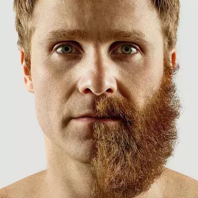 Beards