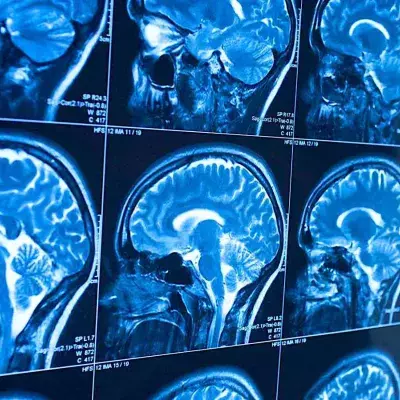 Brain
