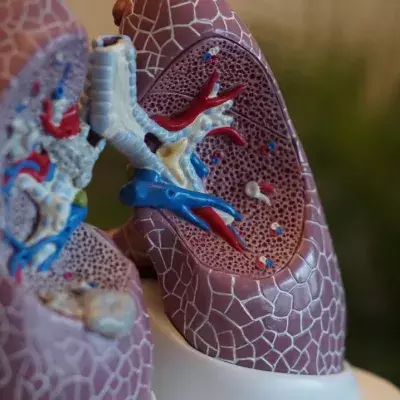 CAT scans reveal COVID damage on people lungs