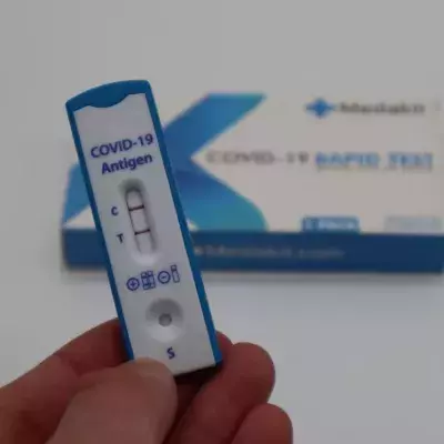 The dangerous reason why you shouldn’t post pictures of your Covid test online