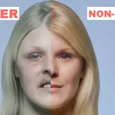 Default image