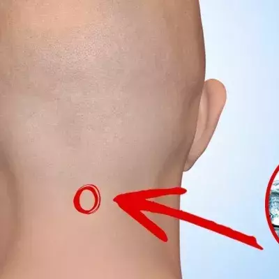 Default image