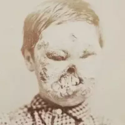 Default image