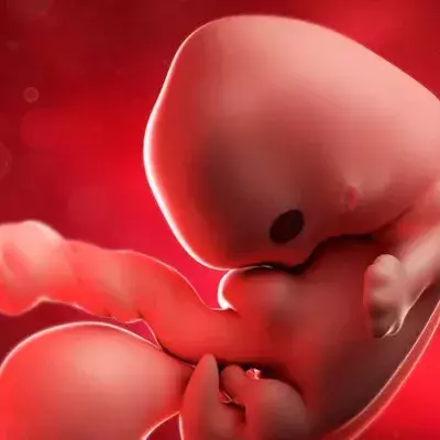 Doctors Discovered Hair, Teeth And Bones In A Teenager’s Stomach. It Turned Out To Be Her Twin