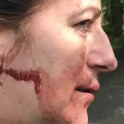 Dog Walker Left Unconscious 