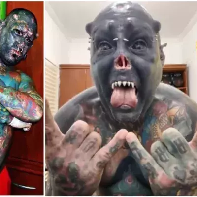 Fernando Franco de Oliveira has undergone multiple body modification surgeries over the decade