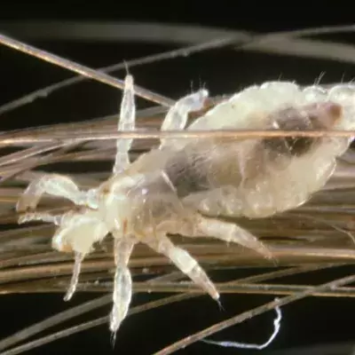 Lice