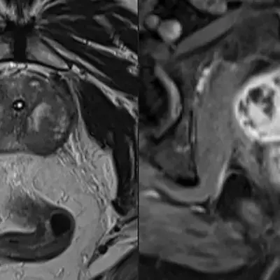 Man almost dies after having a 15 inch eel removed from his anus