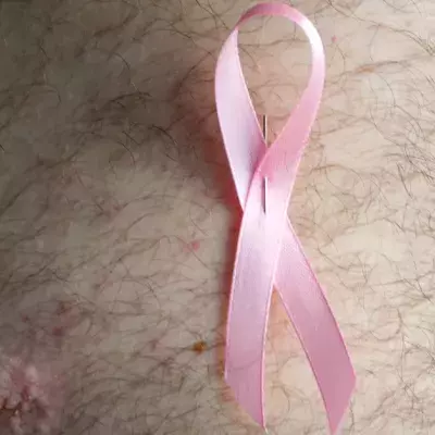 Men Die From Breast Cancer More Often Than Women