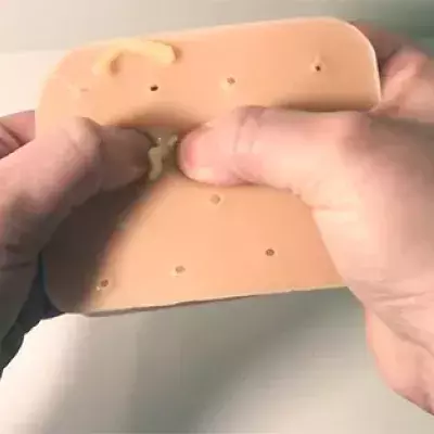 The New Internet Trend: A Toy For Popping Pimples.
