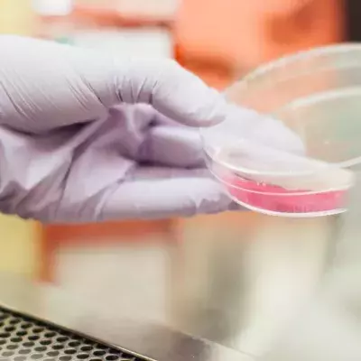 Petri dish