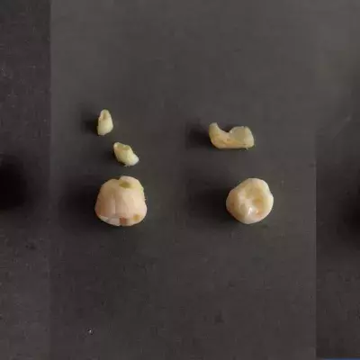 She Made Earrings Out Of Her Wisdom Teeth
