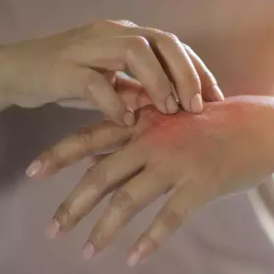 Skin irritations