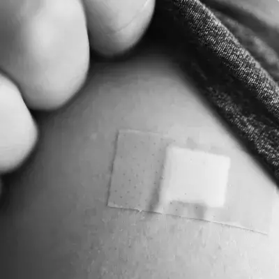 Skin reactions