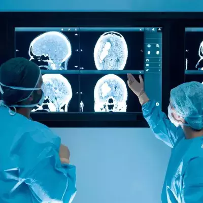 Study finds over 80% of hospitalised COVID patients left with brain damage