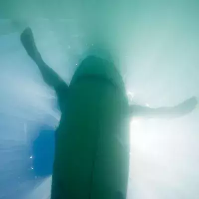 Surfer reveals horror injury after fist fight with great white shark