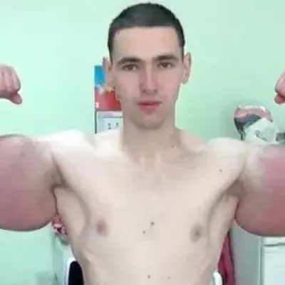 Synthol