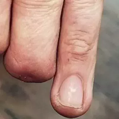 This Tattoo Artist Is Doing Something Incredible For Amputees