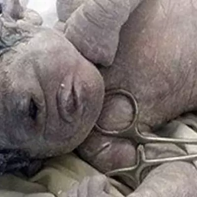 A Woman In Egypt Recently Gave Birth To A ‘Cyclops Baby’