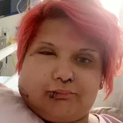 Woman’s face swells to twice the size after brushing against this toxic plant