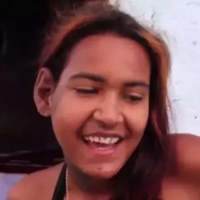 This Young Woman Suffers From A Rare Condition: She Has Huge Feet As A Result Of It