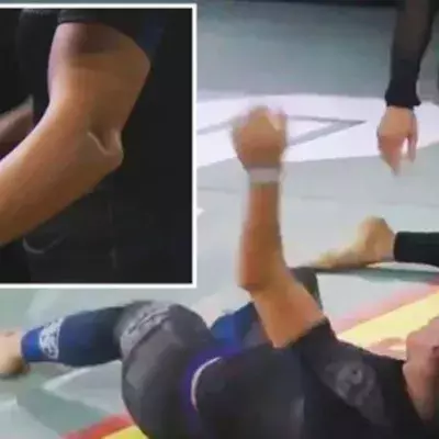 Former UFC Fighter Forces Her Opponent To Submit After She Breaks Her Arm
