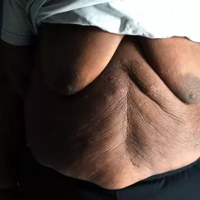 This morbidly obese Youtube stopped eating for 150 days to save his life